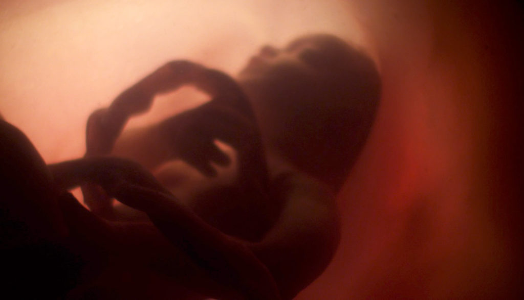 Image of preborn child in the womb.